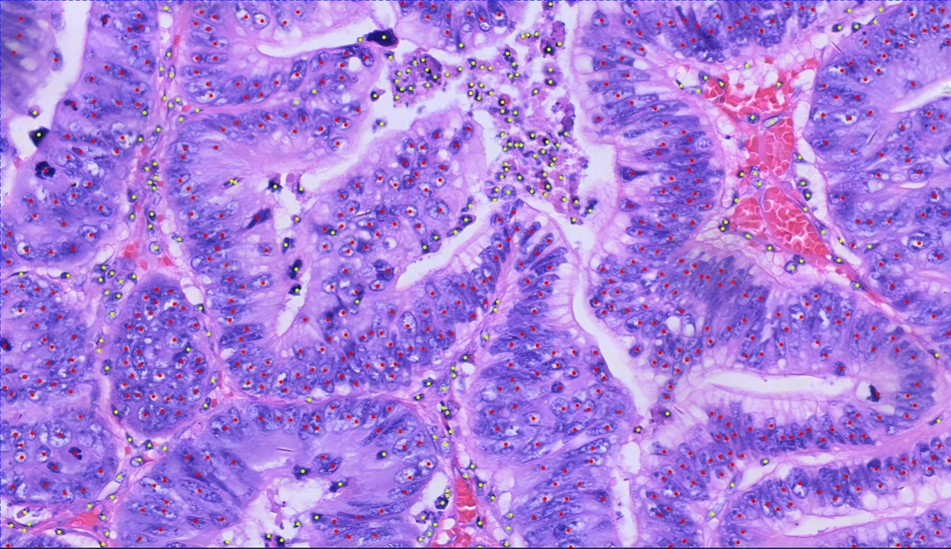 Cellular Segmentation Analysis