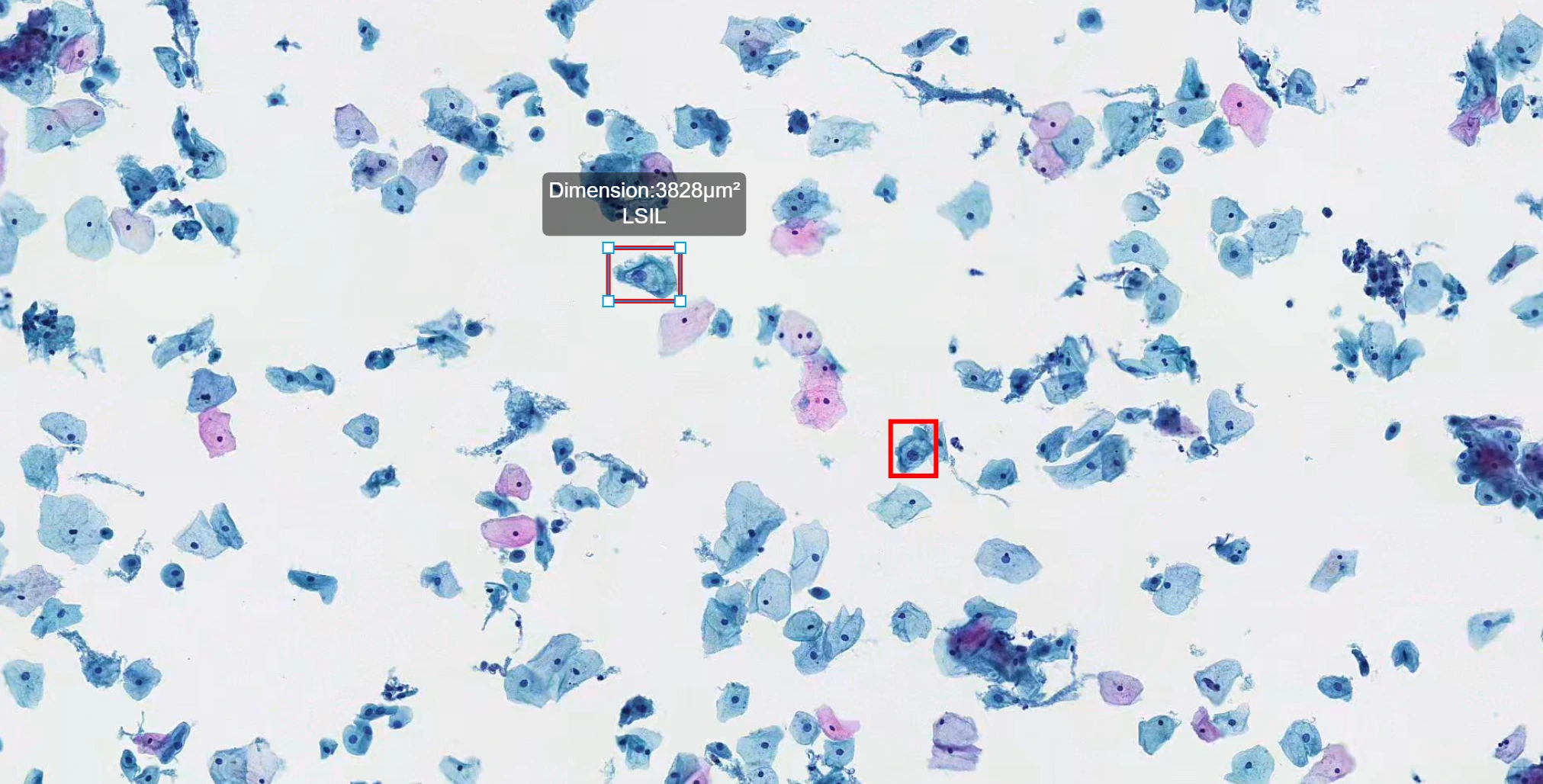 D-PathAI Cytology Screening