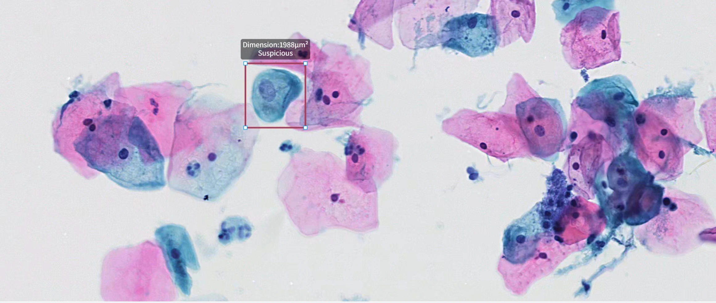 D-PathAI Cytology Screening