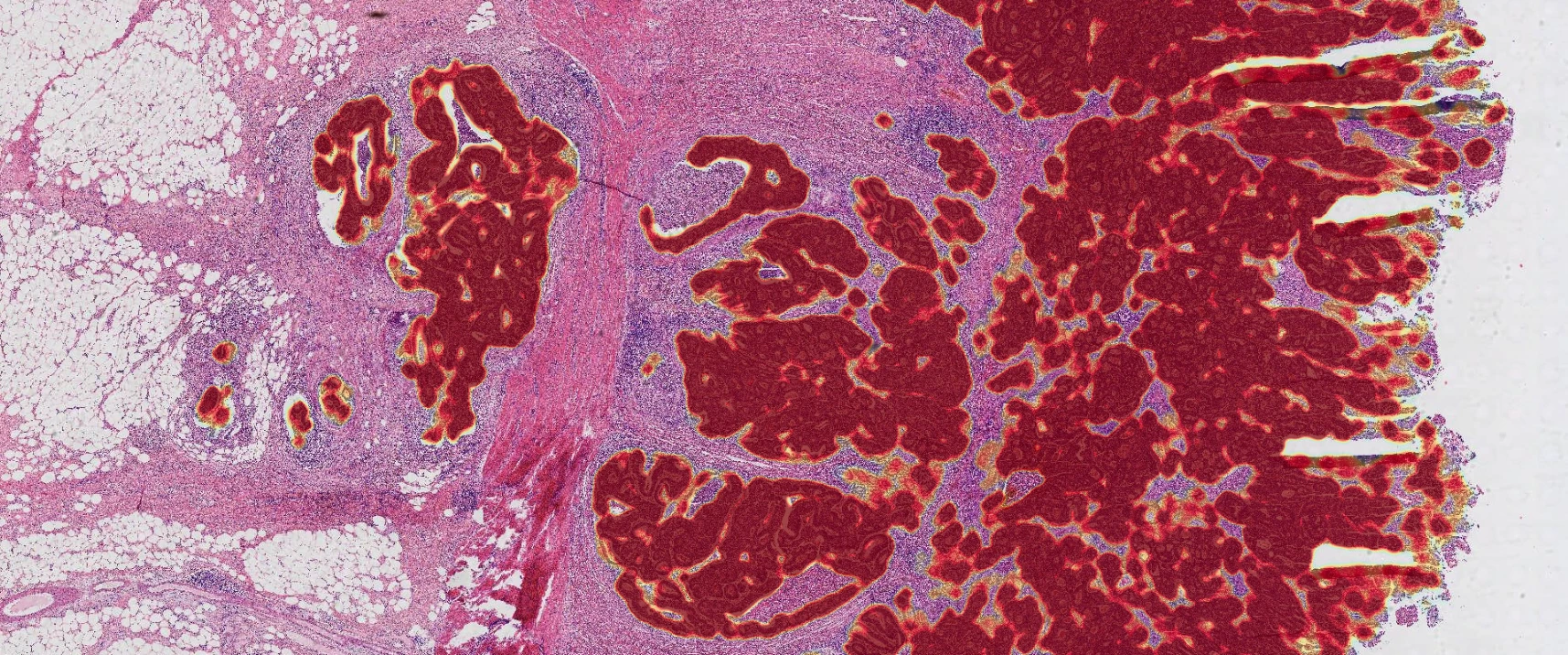 D-PathAI HE Clinical Assistance