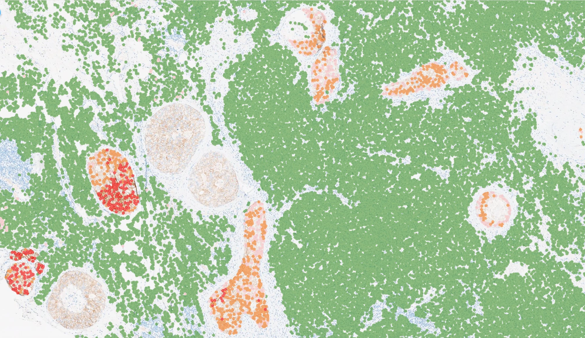 D-PathAI IHC Quantification