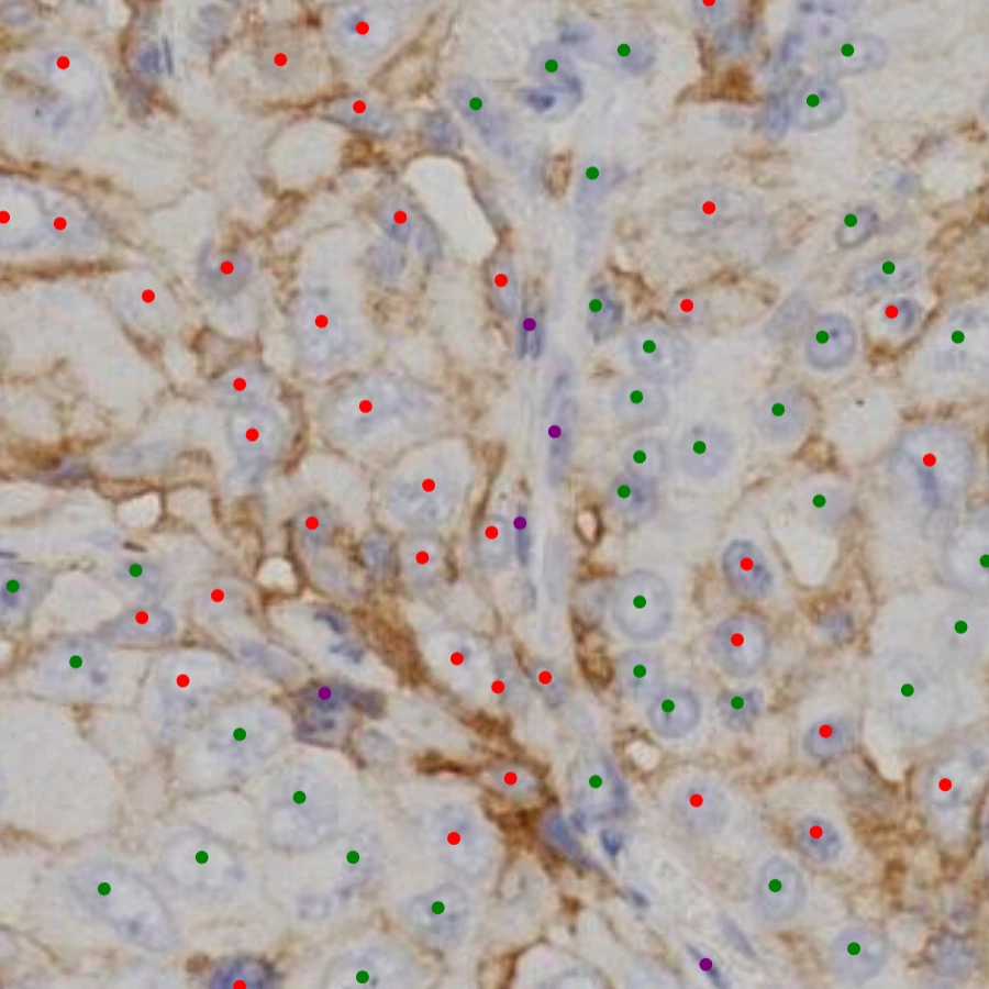 High Magnification Pathology View