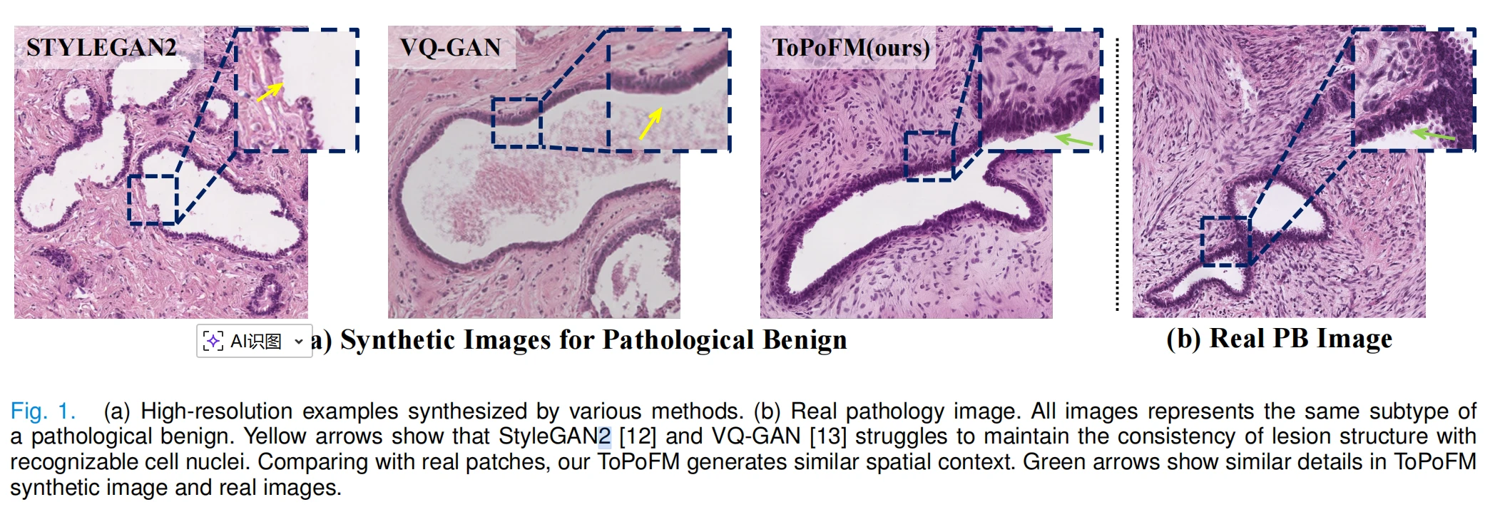 ToPoFM paper figure visual
