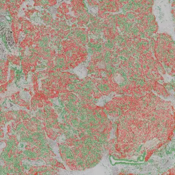 Патологическое изображение при малом увеличении